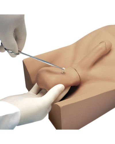 No Scalpel Vasectomy (NSV) Model